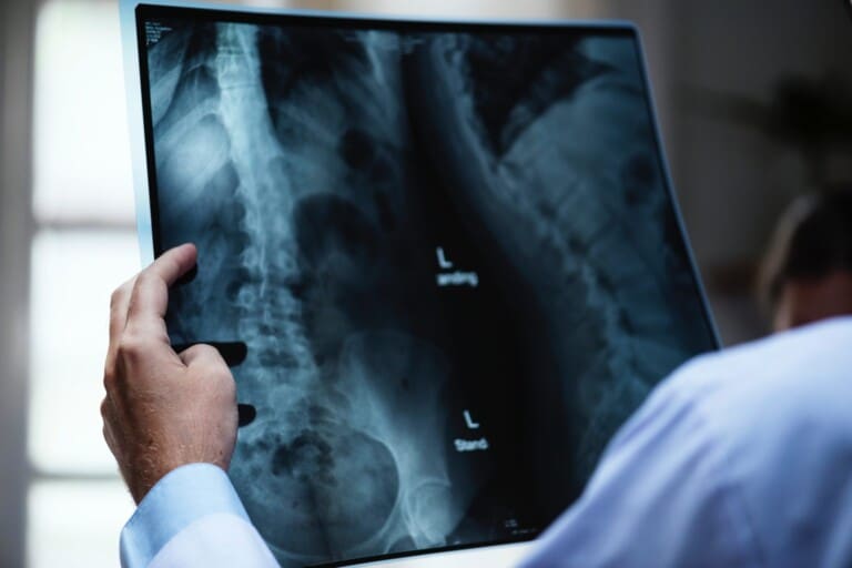 x-ray-e1512847722230