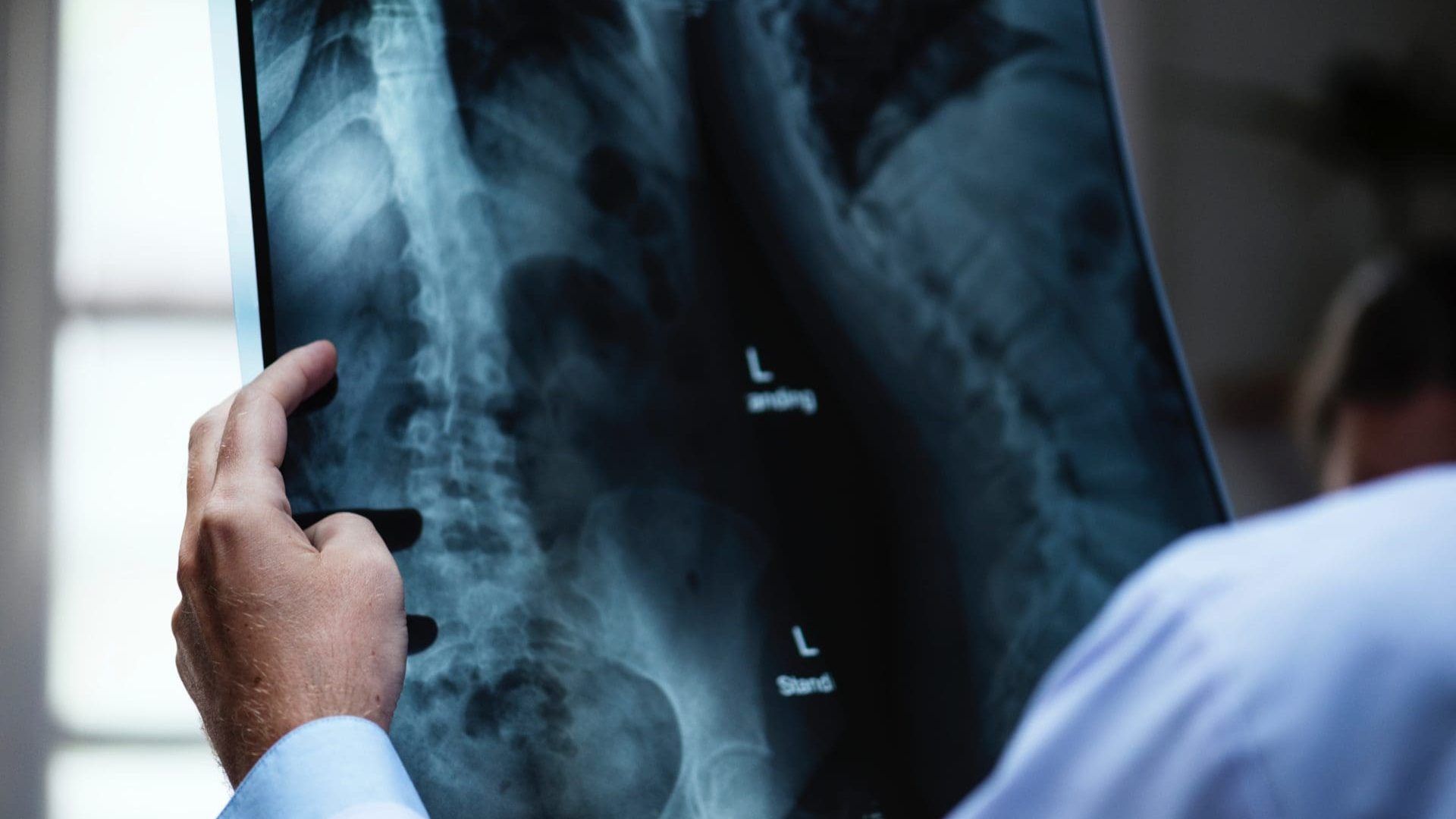 x-ray-e1512847722230